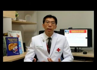 ตับแข็ง : G3.1