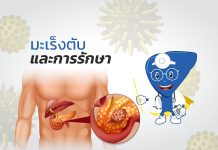 มะเร็งตับและการรักษา : H2.3