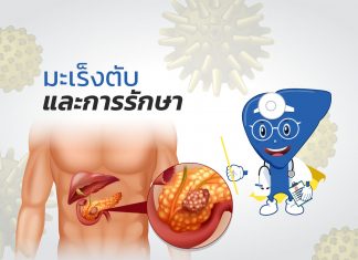 มะเร็งตับและการรักษา : H2.3