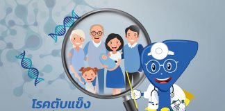 โรคตับแข็ง : G1