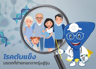 โรคตับแข็ง : G1