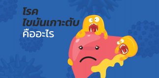 โรคไขมันเกาะตับคืออะไร??? : F1