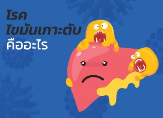โรคไขมันเกาะตับคืออะไร??? : F1