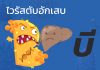 ไวรัสตับอีกเสบ “บี” : B1