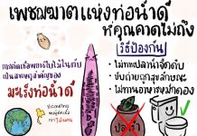 เพชฌฆาตท่อน้ำดีที่คุณคาดไม่ถึง!