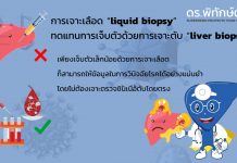 การตรวจหาความผิดปกติจากการเจาะเลือด “liquid biopsy” ทดแทนการเจ็บตัวด้วยการเจาะตับ “liver biopsy”