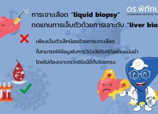 การตรวจหาความผิดปกติจากการเจาะเลือด “liquid biopsy” ทดแทนการเจ็บตัวด้วยการเจาะตับ “liver biopsy”