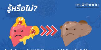 โรคไขมันพอกตับก่อให้เกิดมะเร็งตับได้โดยไม่จำเป็นต้องมีภาวะตับแข็งร่วมด้วย