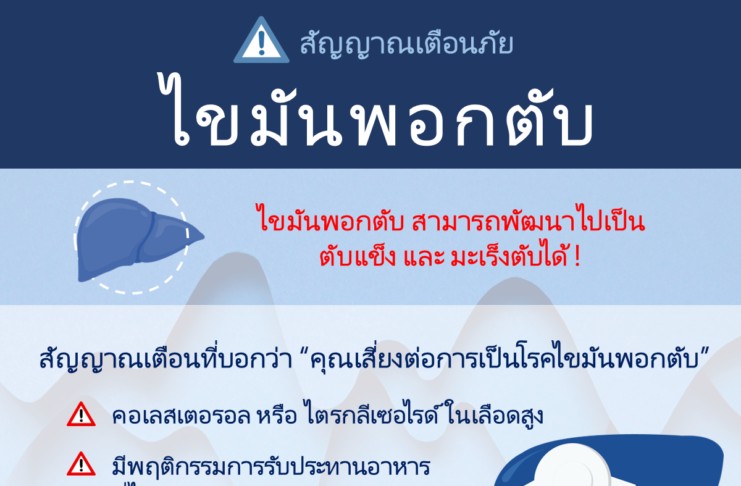 สัญญาณเตือนภัย ไขมันพอกตับ